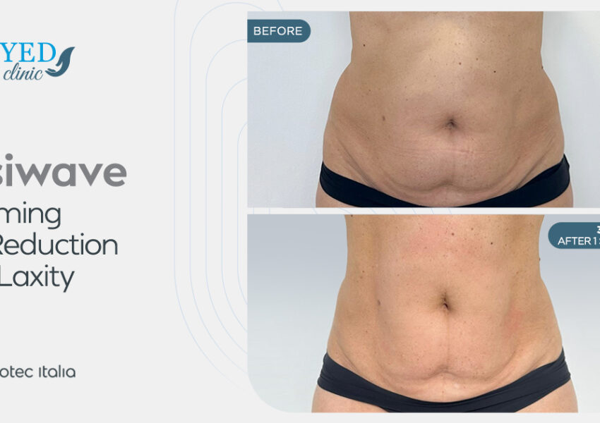 عيادة Medyed تجربة شاملة للعلاجات التجميلية والعافية المتقدمة